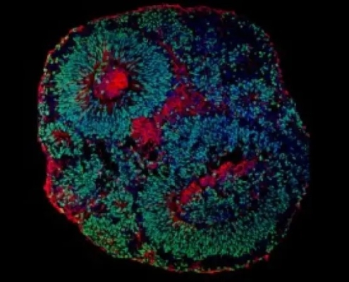 Minicérebros (organoides cerebrais) no Muotri Lab, na UCSD — Universidade da Califórnia em San Diego (EUA) - Canal Autismo / Revista Autismo