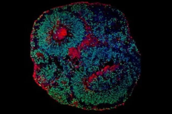 Minicérebros (organoides cerebrais) no Muotri Lab, na UCSD — Universidade da Califórnia em San Diego (EUA) - Canal Autismo / Revista Autismo