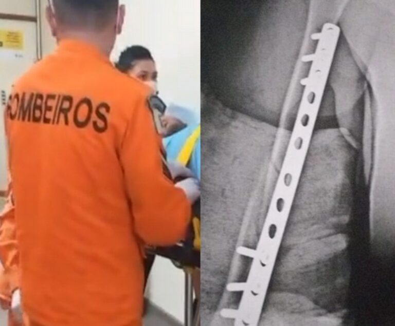 Policial quebra braço de aluno autista no Distrito Federal — Canal Autismo / Revista Autismo